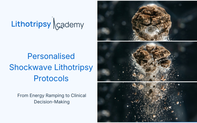 Personalised shockwave lithotripsy Protocol by Lithotripsy Academy