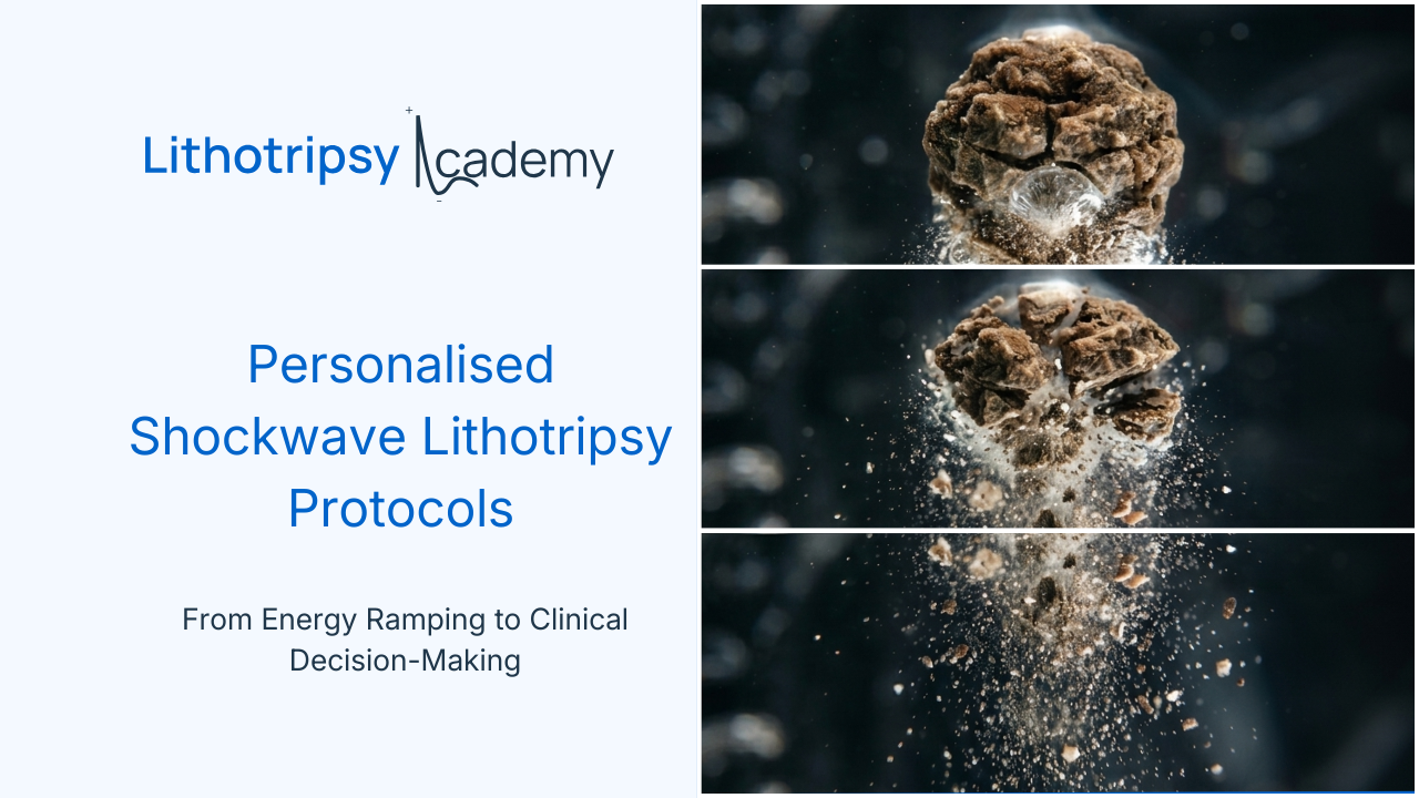 Personalised Shockwave Lithotripsy Protocols